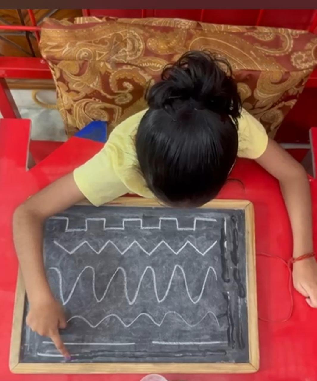 Healing Hands Neuro Physiotherapy Centre Lajpat Nagar-1, New Delhi , Dynamic Movement Intervention (DMI) Therapy in Delhi, Muscle Tone, Segmental Control, and Proper Alignment(MTF-Focused Therapy), Neurodevelopmental Therapy (NDT), Neurological Physiotherapy, Speech Therapy, Toe Walking in Delhi